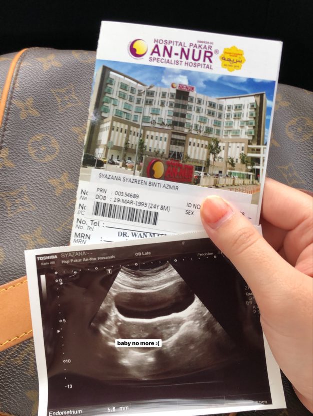 How I Found Out I was Pregnant + Miscarriage at 6 Weeks